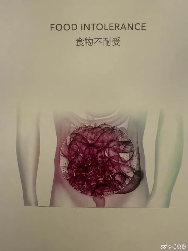 世界杯手机观看平台-演员毛晓彤凌晨从医美诊所离开引网友热议，其晒医院检测报告回应：作为一个从小爱吃面食的天津人，查出面粉不耐受可怎么办